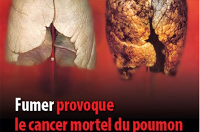 Projet TABAC